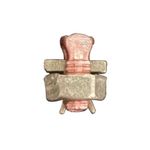 Conector-Parafuso-Fendido-16mm²-Kit-Flex-2-Pecas